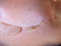 弱った肌を活性化して新しい細胞に